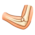 Elbow injury