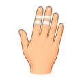 Fingers and hand injury